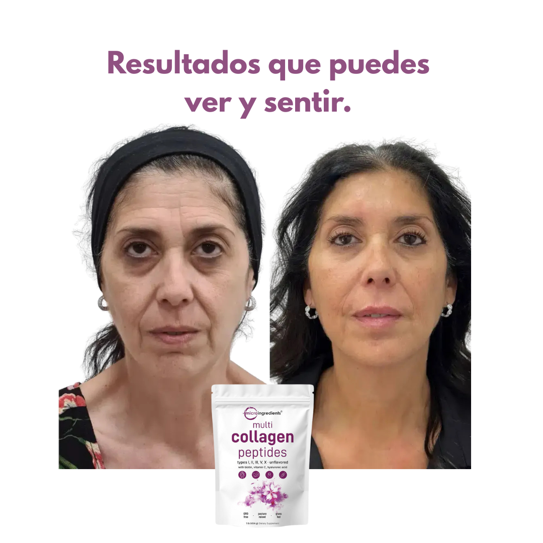 MULTI COLLAGEN PEPTIDES POWDER – ¡No Esperes Más para Ver el Cambio!